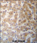 DHFRL1 Antibody (Center)
